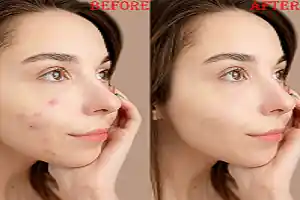 I can do photo touch up high end skin retouch and headshot retouch image