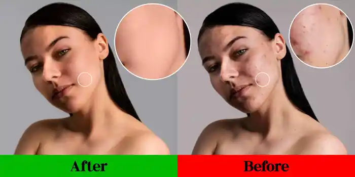 I can upscale photo low to high resolution, sharpen, enlarge and Edit photos